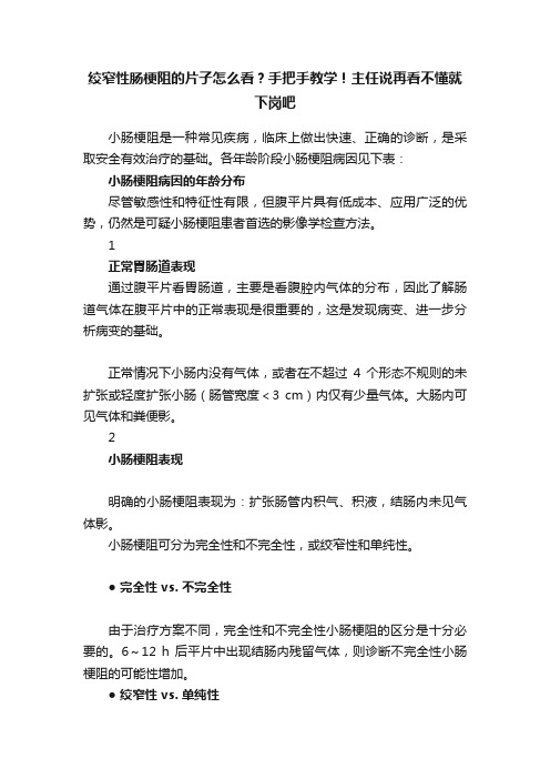 绞窄性肠梗阻的片子怎么看？手把手教学！主任说再看不懂就下岗吧