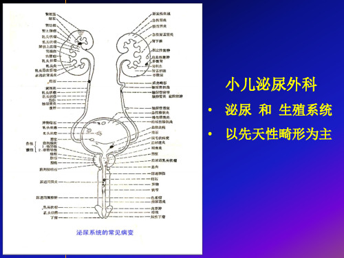 肾盂输尿管连接部梗阻