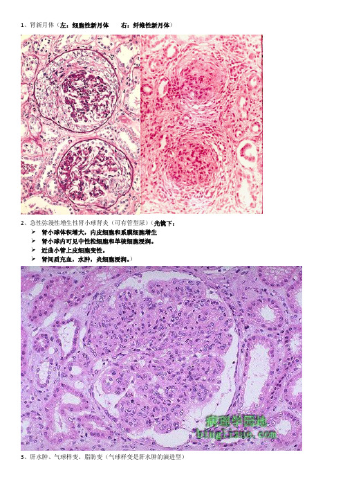 病理学切片复习