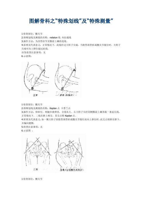 图解骨科之“特殊划线”及“特殊测量”