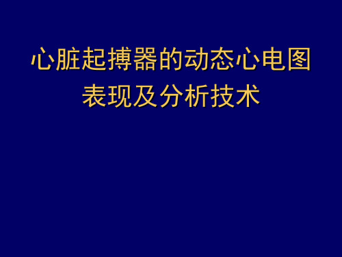 心脏起搏器的动态心电图表现及分析技术课件