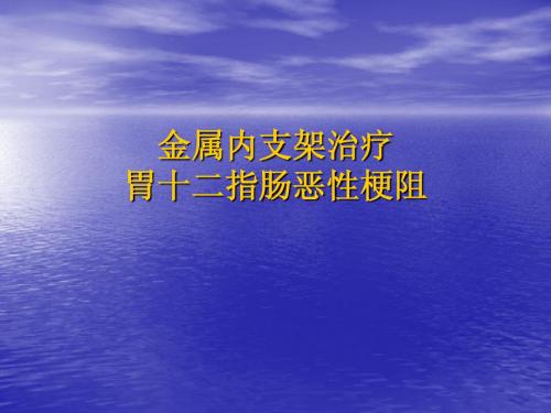 金属内支架治疗胃十二指肠恶性梗阻