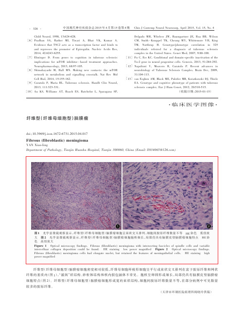 临床医学图像 纤维型(纤维母细胞型)脑膜瘤