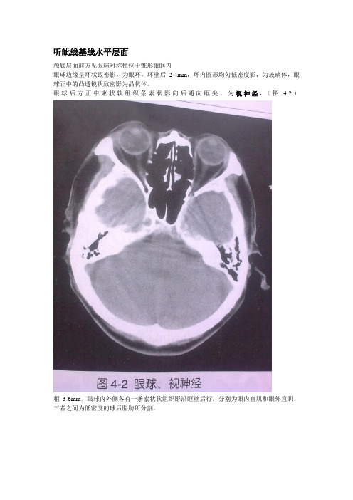 颅脑CT断层诊断图谱