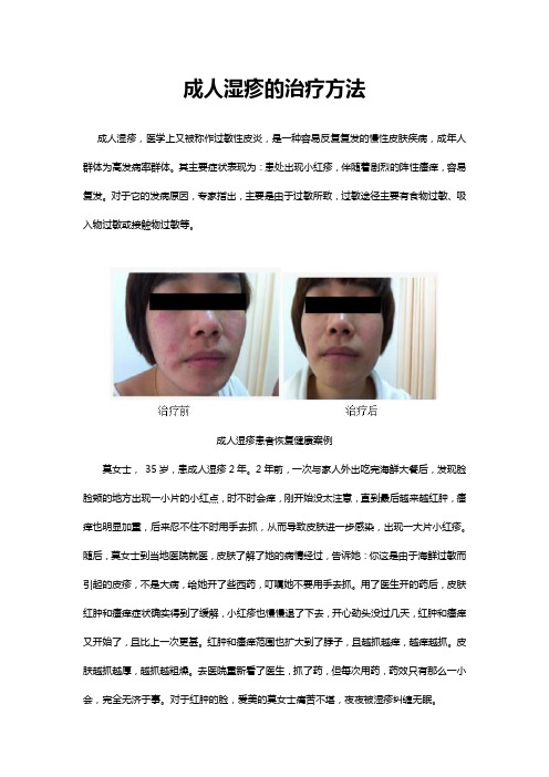 成人湿疹的解决方法