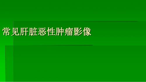 C肝脏恶性肿瘤ppt课件