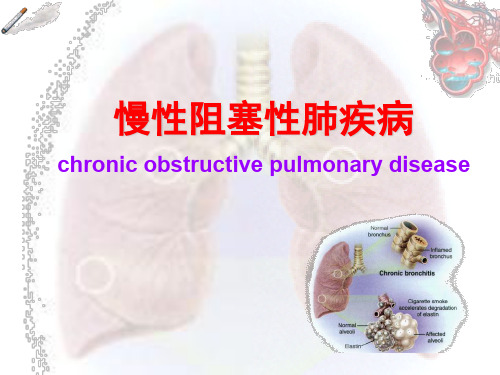 慢性阻塞性肺疾病的护理 PPT课件