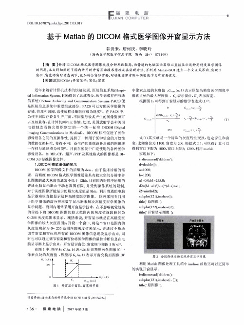 基于Matlab的DICOM格式医学图像开窗显示方法