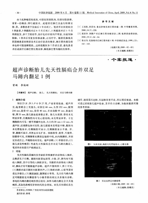 超声诊断胎儿先天性膈疝合并双足马蹄内翻足1例