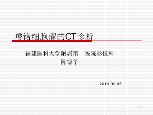 嗜铬细胞瘤的ct诊段PPT演示文稿