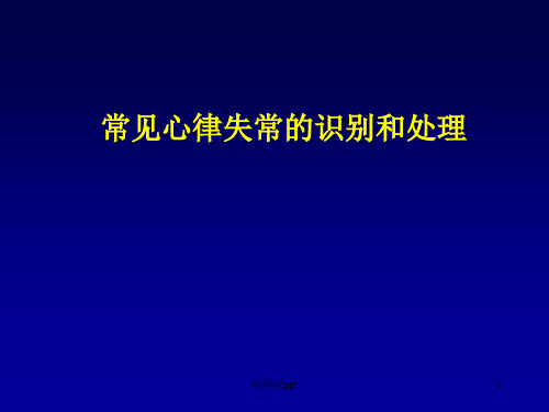 常见心律失常的识别和处理