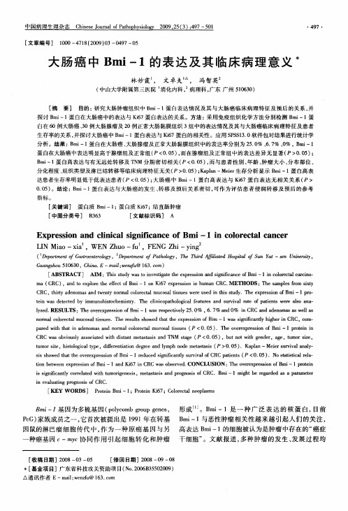 大肠癌中Bmi-1的表达及其临床病理意义