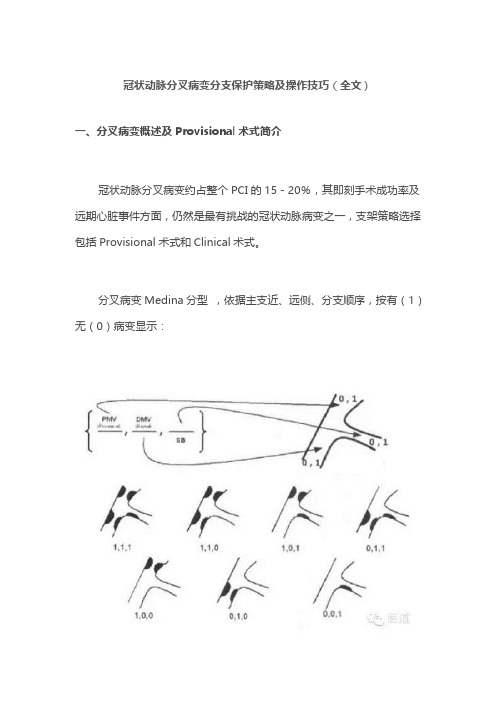 冠状动脉分叉病变分支保护策略及操作技巧(全文)