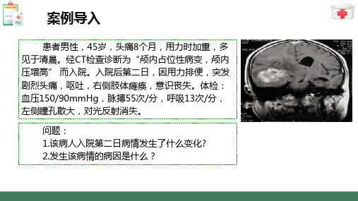 颅内压增高病人的护理—颅内压增高定义、病因、病理