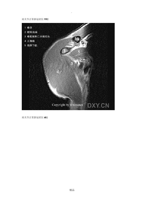 肩关节正常MRI解剖图谱