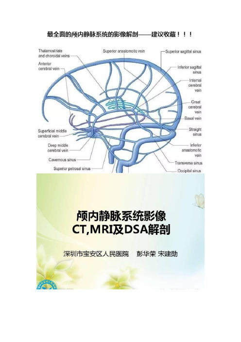 最全面的颅内静脉系统的影像解剖——建议收藏！！！