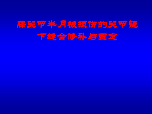 膝关节半月板损伤的关节镜下缝合修补与固定