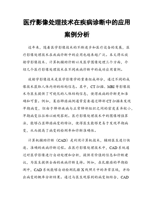 医疗影像处理技术在疾病诊断中的应用案例分析