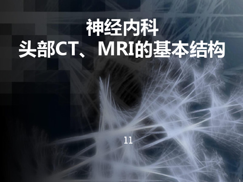 神经内科头部CT、MRI的基本结构