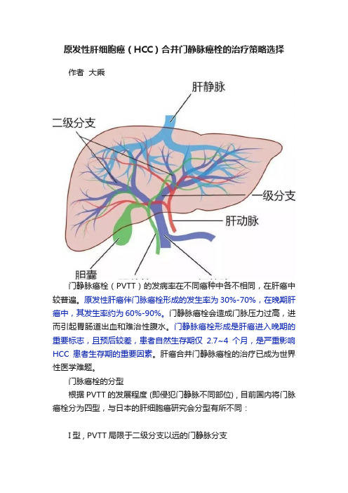 原发性肝细胞癌（HCC）合并门静脉癌栓的治疗策略选择