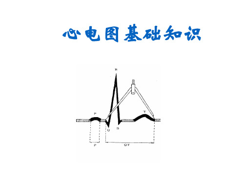 心电图基础知识