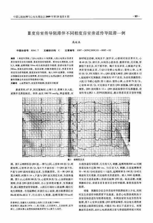 Ⅲ度房室传导阻滞伴不同程度房室旁道传导阻滞一例