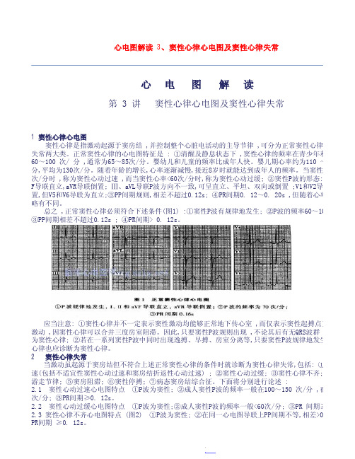 窦性心律心电图及窦性心律失常