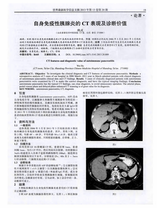 自身免疫性胰腺炎的 CT 表现及诊断价值