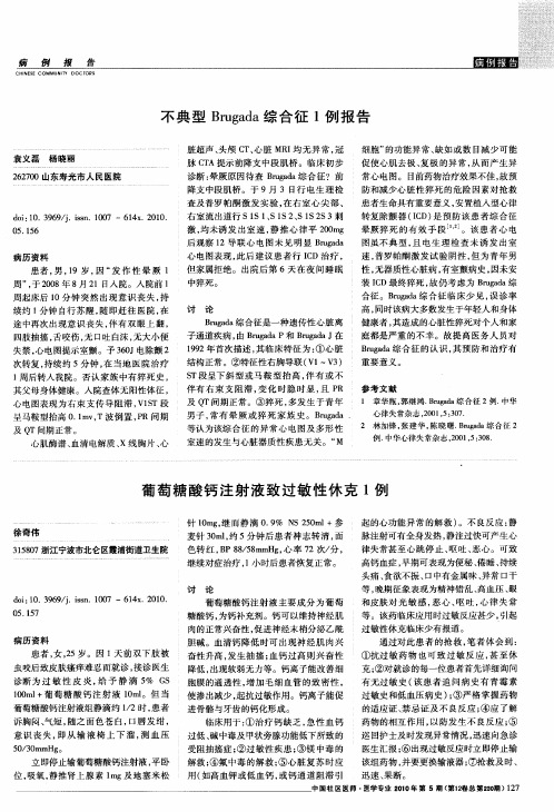 不典型Brugada综合征1例报告