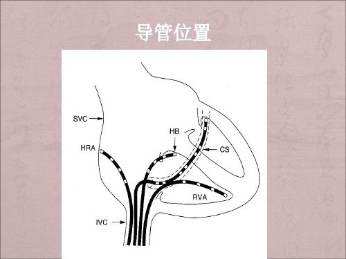 心脏电生理检查的基础知识  2月份PPT幻灯片