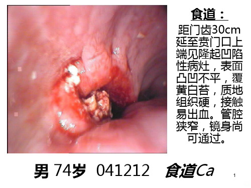 电子胃镜图片PPT课件