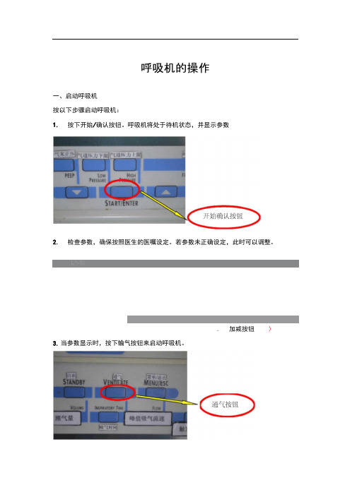 完整版呼吸机操作流程图图文并茂版