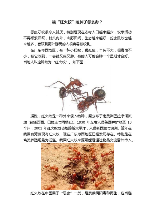 被“红火蚁”咬肿了怎么办？