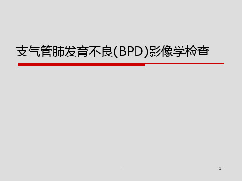 支气管肺发育不良影像学检查PPT课件