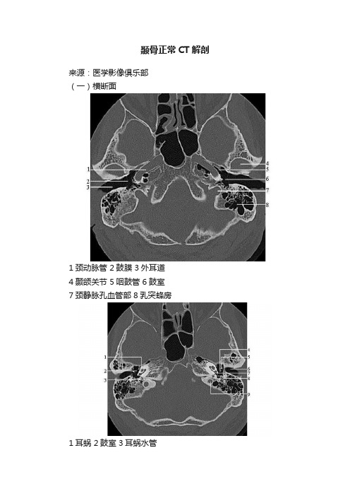 颞骨正常CT解剖