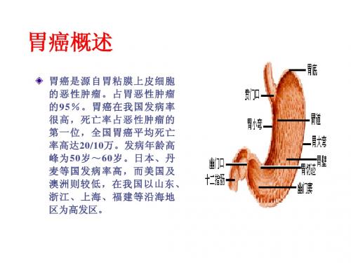 胃癌