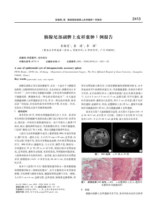 胰腺尾部副脾上皮样囊肿1例报告