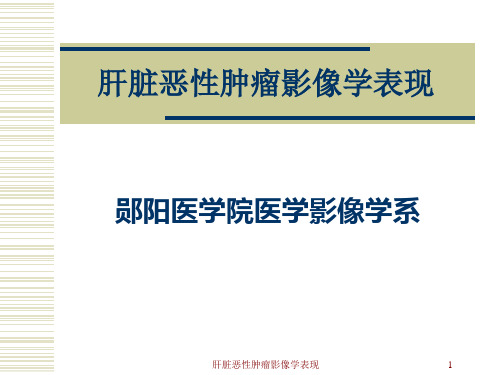 肝脏恶性肿瘤影像学表现课件