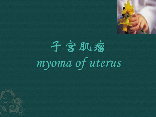 子宫肌瘤ppt课件