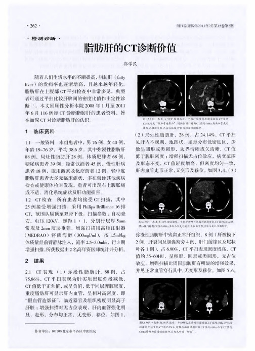 脂肪肝的CT诊断价值