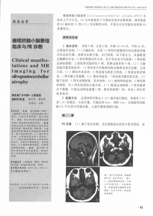 橄榄桥脑小脑萎缩临床与MR诊断