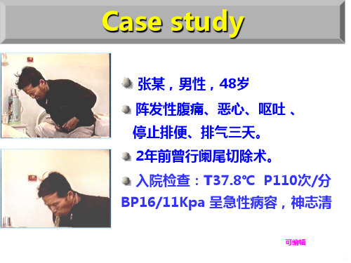 外科肠梗阻PPT课件