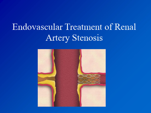 肾动脉支架植入术图文详解PPT优秀课件