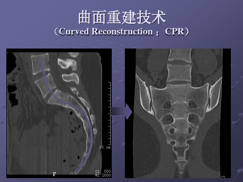 影像技术学 CTmr检查技术新