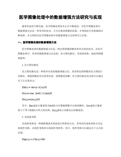 医学图像处理中的数据增强方法研究与实现