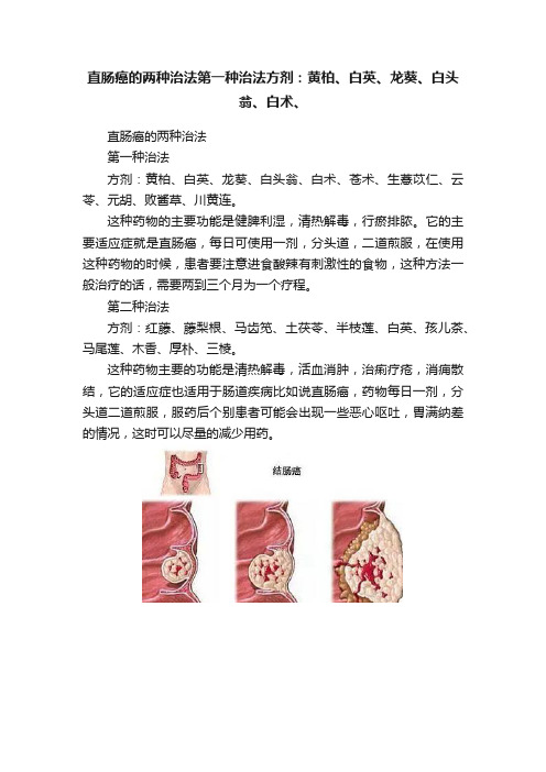 直肠癌的两种治法第一种治法方剂：黄柏、白英、龙葵、白头翁、白术、