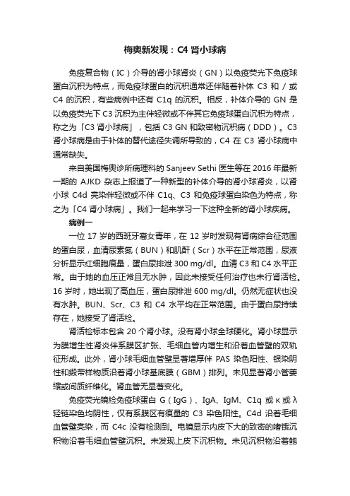 梅奥新发现：C4肾小球病