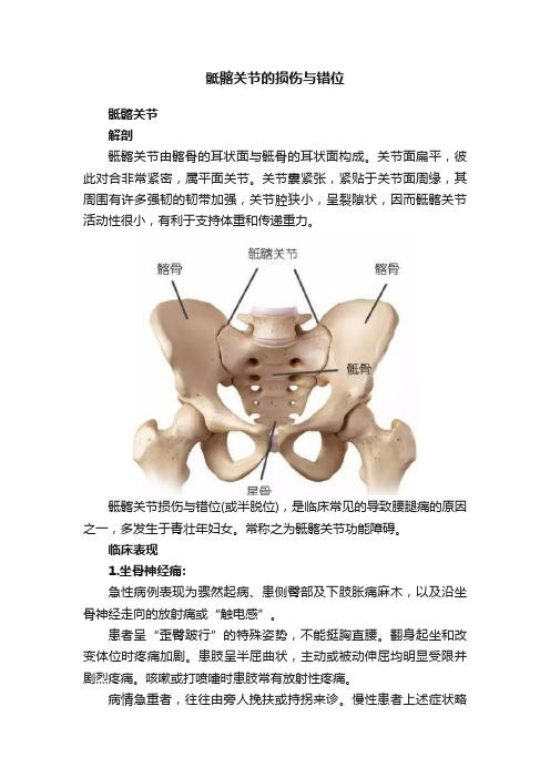 骶髂关节的损伤与错位