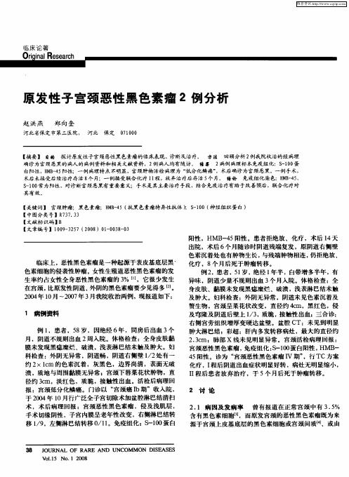 原发性子宫颈恶性黑色素瘤2例分析