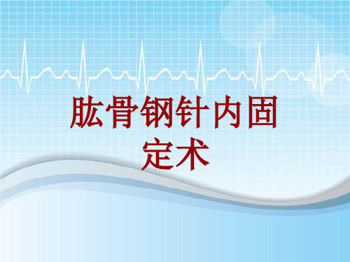 外科手术教学资料：肱骨钢针内固定术讲解模板